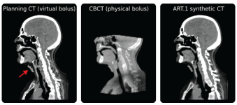 Example of a challenging case